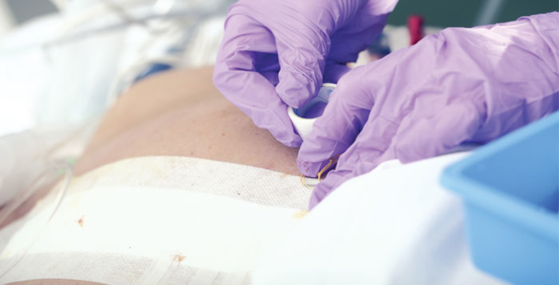 3M Cavilon Advanced Skin Protectant