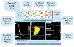 The Deltex TrueVue Loops display gives a complete picture of flow, pressure and resistance The Deltex TrueVue Loops display gives a complete picture of flow, pressure and resistance