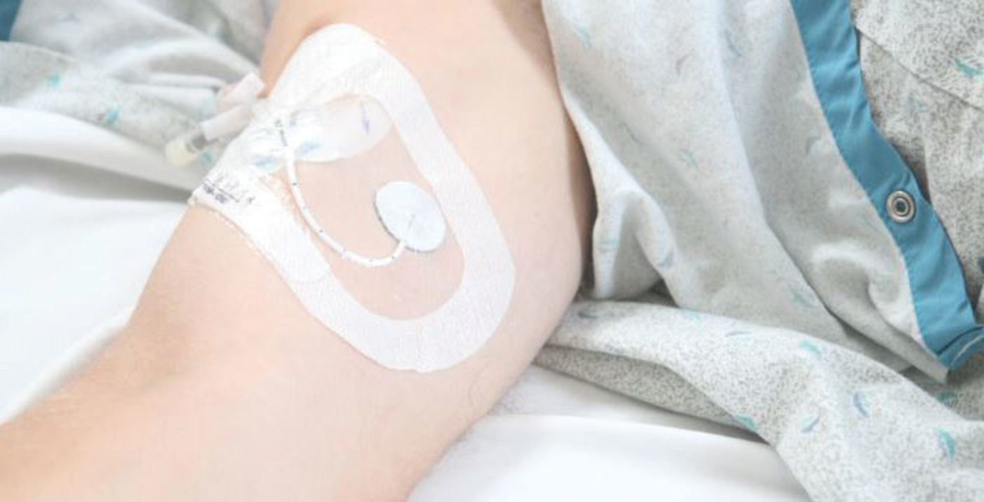 Photo courtesy Argentum Medical