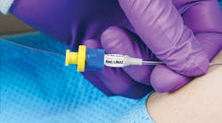 Access Scientific’s POWERWAND Access Scientific’s POWERWAND