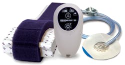 Acelity’s PREVENA Incision Management System Acelity’s PREVENA Incision Management System