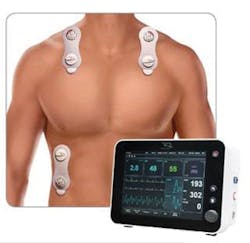 Cheetah Starling SV hemodynamic monitoring system and 100 percent non-invasive sensors Cheetah Starling SV hemodynamic monitoring system and 100 percent non-invasive sensors