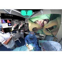 Mativision V Rin Or Image Mativision V Rin Or Image