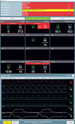 The Bernoulli Respiratory Depression Surveillance System, displaying ventilator and cardiac waveforms. The Bernoulli Respiratory Depression Surveillance System, displaying ventilator and cardiac waveforms.