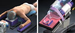 Xodus Medical’s Surgical BackPacks (left) and Pink PadXL (right) positioners Xodus Medical’s Surgical BackPacks (left) and Pink PadXL (right) positioners