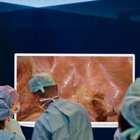 Olympus Visera Image Olympus Visera Image