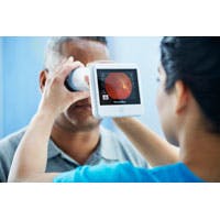 Welch Allyn Retina Vue 100 Welch Allyn Retina Vue 100