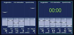 Figure 1. Hamilton Medical AG ventilators display the Vent Status Panel, indicating status of the patient’s ventilator dependence. Figure 1. Hamilton Medical AG ventilators display the Vent Status Panel, indicating status of the patient’s ventilator dependence.