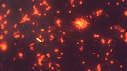 A photomicrograph of a sputum smear reveals the presence tuberculosis bacterium. A photomicrograph of a sputum smear reveals the presence tuberculosis bacterium.