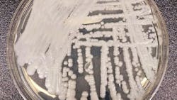 A strain of Candida auris cultured in a petri dish at the Centers for Disease Control and Prevention A strain of Candida auris cultured in a petri dish at the Centers for Disease Control and Prevention