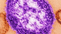 Photo Courtesy Centers For Disease Control And Prevention 5d38540260a11 Photo Courtesy Centers For Disease Control And Prevention 5d38540260a11