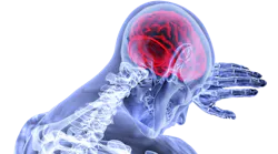 Brain 3168269 1920