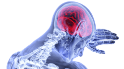 Brain 3168269 1920 5d2c9b136f5bb Brain 3168269 1920 5d2c9b136f5bb