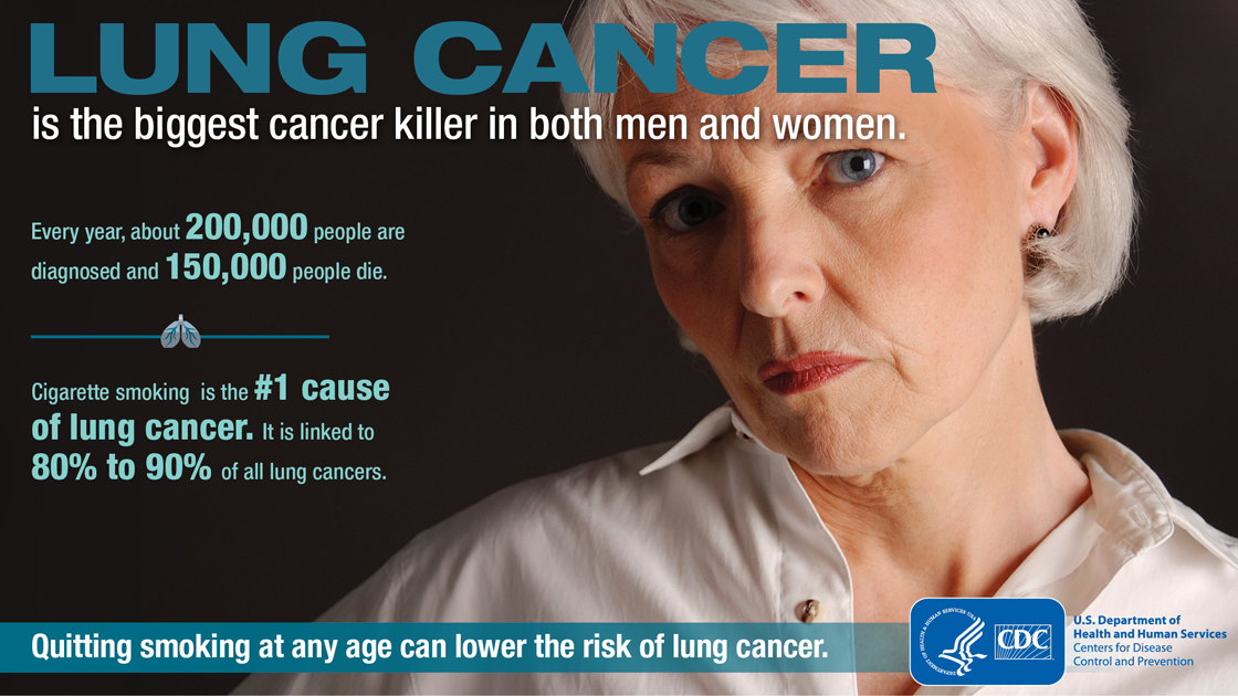 Lungcancer 1200x630 Fbk 5d41a7eec03bd