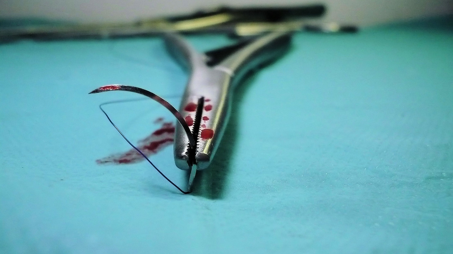 Surgery 1662206 1920 5d30759355636