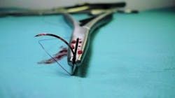 Surgery 1662206 1920 5d30759355636 Surgery 1662206 1920 5d30759355636