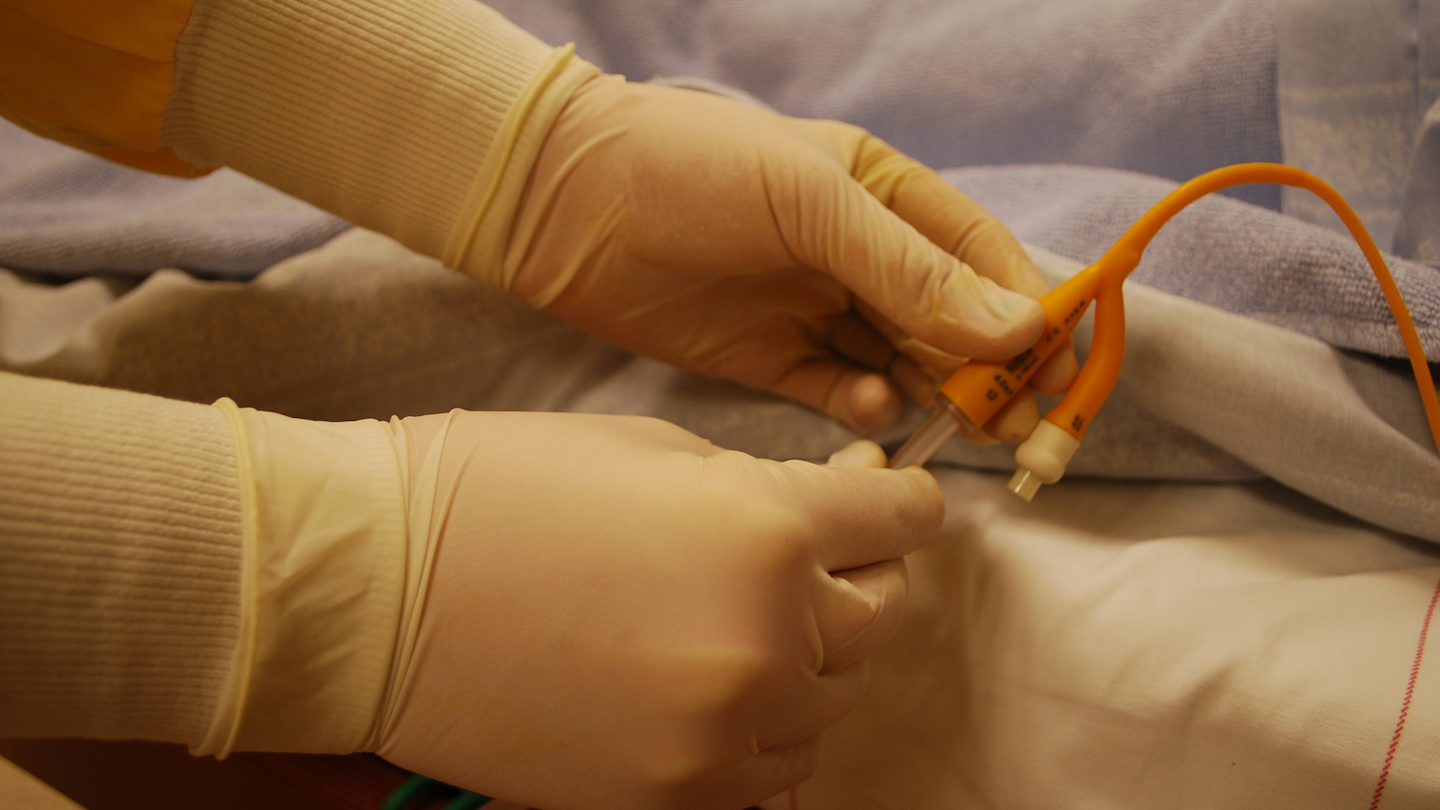 Catheters Big source of infection, often overlooked Healthcare Purchasing News