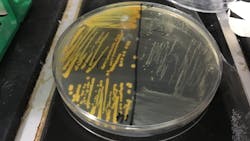 Cigarette smoke accelerates the emergence of antibiotic resistant Small Colony Variants (SCVs) in the human pathogen, Staphylococcus aureus. Left panel shows normal wild-type S aureus; Right panel shows gentamicin-resistant SCVs. Cigarette smoke accelerates the emergence of antibiotic resistant Small Colony Variants (SCVs) in the human pathogen, Staphylococcus aureus. Left panel shows normal wild-type S aureus; Right panel shows gentamicin-resistant SCVs.