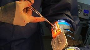 The Operative Armour System by Sharp Fluidics