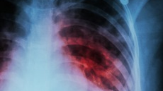 Photo: National Institutes of Health