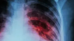Photo: National Institutes of Health