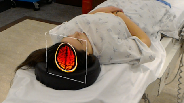 OpenSight Augmented Reality System from Novarad