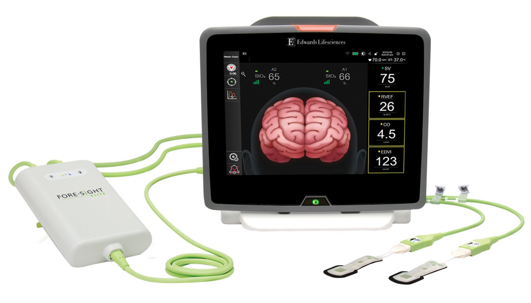 All the bells and whistles | Healthcare Purchasing News