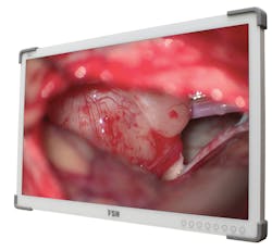 FSN Medical Technologies model FM-E3203DG, 32 inch 4K surgical display monitor FSN Medical Technologies model FM-E3203DG, 32 inch 4K surgical display monitor