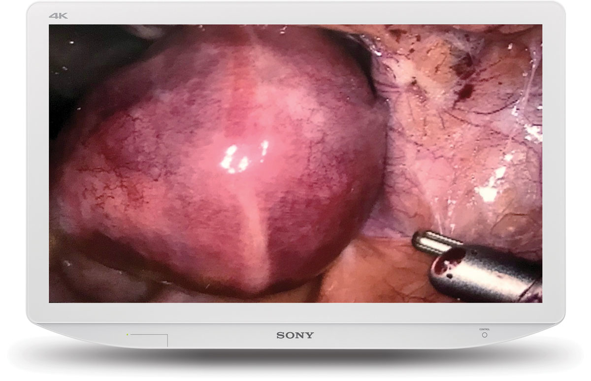 Sony 27” 4K Medical Display