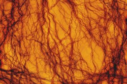 Cedars Sinai Women S Faster Blood Vessels Pic 1 17 20du Lightning 3708390 1920 Pixabay 5e21e038050d8 Cedars Sinai Women S Faster Blood Vessels Pic 1 17 20du Lightning 3708390 1920 Pixabay 5e21e038050d8