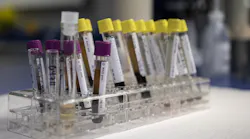 Fda Advancements Development Coronavirus Medical Products Pic 1 29 20du Blood 3511766 1920 Pixabay