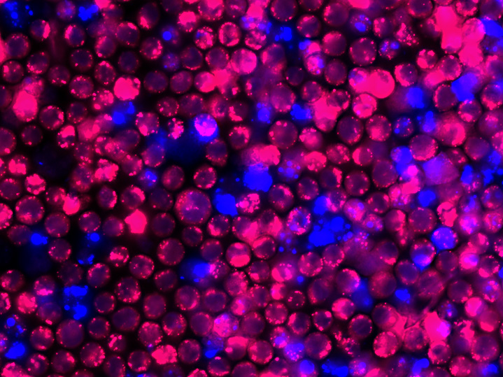 Nih Scientists Hiv And Siv Latency In Animals Pic 1 23 20du 5388373910 69827c3eff O Flickr Fda 5e29b163c7ab2