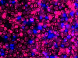 Nih Scientists Hiv And Siv Latency In Animals Pic 1 23 20du 5388373910 69827c3eff O Flickr Fda 5e29b163c7ab2 Nih Scientists Hiv And Siv Latency In Animals Pic 1 23 20du 5388373910 69827c3eff O Flickr Fda 5e29b163c7ab2