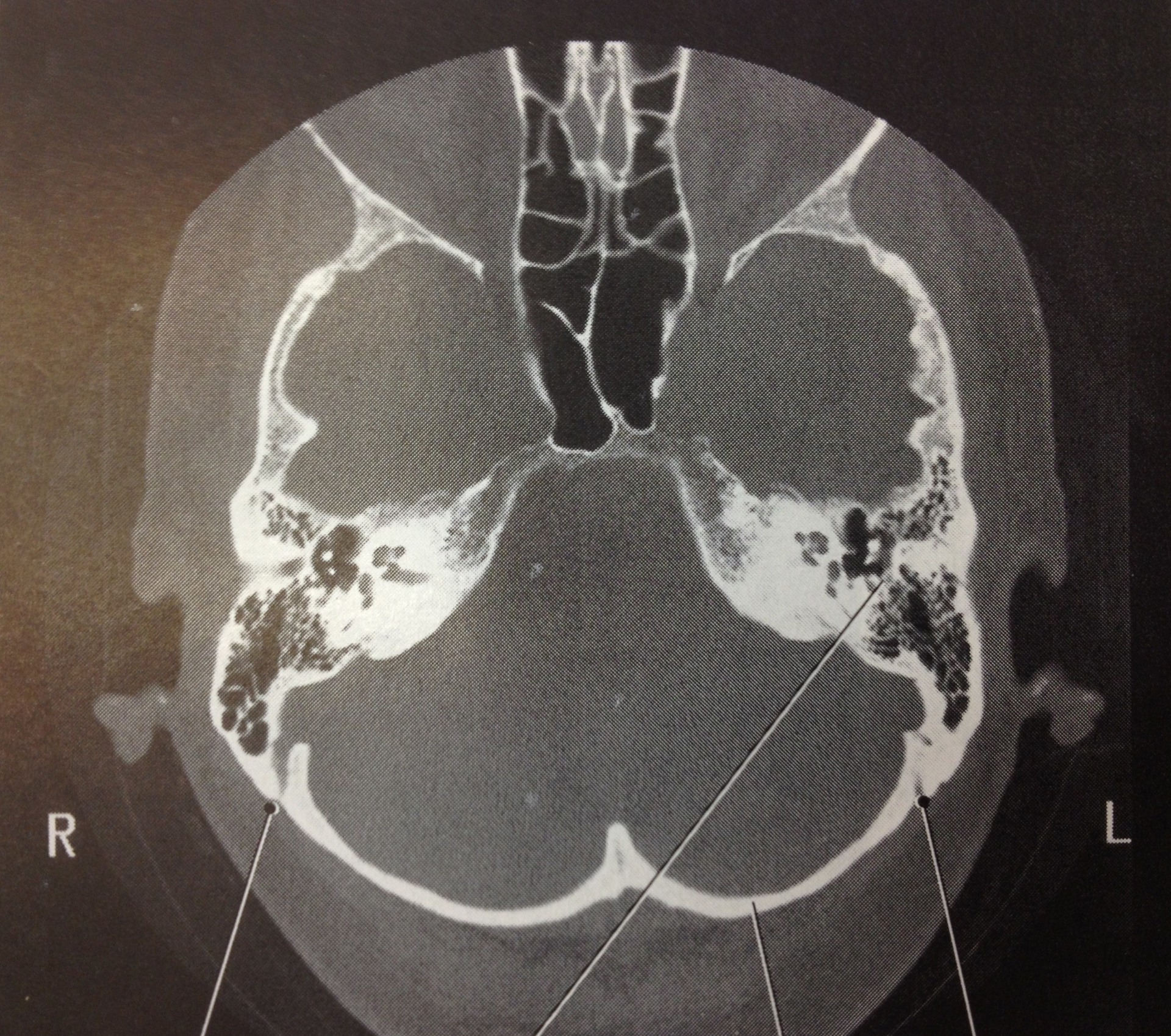 Ut Health Simple And Advanced Ct Imaging Stroke Thrombectomy Pic 1 24 20du 8147030031 064d36e7d0 O Flickr Fda 5e2afeb16072c