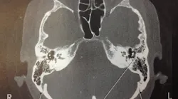 Ut Health Simple And Advanced Ct Imaging Stroke Thrombectomy Pic 1 24 20du 8147030031 064d36e7d0 O Flickr Fda