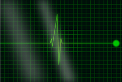 Viva Lnk Fda Cleared Wearable Ecg Sensor Pic 12 28 20du Frequency 309372 Pixabay 5e30460d66f7e Viva Lnk Fda Cleared Wearable Ecg Sensor Pic 12 28 20du Frequency 309372 Pixabay 5e30460d66f7e