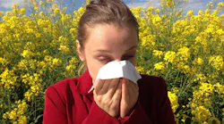 Cdc Confirms Possible Instance Of Community Spread Of Covid 19 In U s Pic 2 27 20du Allergy 1738191 1920 Pixabay