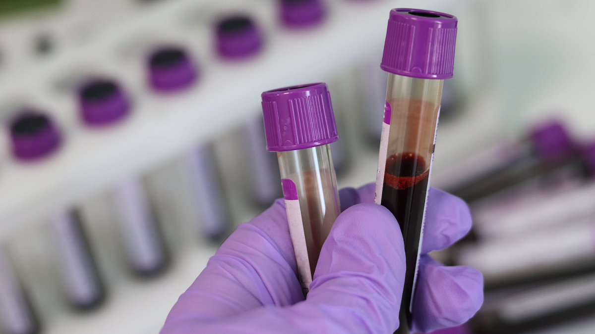 Auto Care Association >> CDC’s COVID-19 test may start use in public labs ... Auto Care Association >> CDC’s COVID-19 test may start use in public labs ...