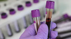 Cidrap Cdc's Covid 19 Test May Start In Public Labs Pic 2 28 20du Laboratory 3827736 1920 Pixabay