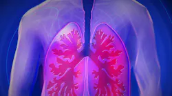 Mount Sinai Physicians First In U s To Analyze Lung Disease With Covid 19 Pic 2 28 20du Upper Body 944557 1280 Pixabay