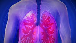 Mount Sinai Physicians First In U s To Analyze Lung Disease With Covid 19 Pic 2 28 20du Upper Body 944557 1280 Pixabay 5e5938df8140c Mount Sinai Physicians First In U s To Analyze Lung Disease With Covid 19 Pic 2 28 20du Upper Body 944557 1280 Pixabay 5e5938df8140c