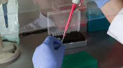 Tulane Researchers Developing Rapid Test For Tb Using Dod Grant Pic 2 24 20du Laboratory 2813892 1920 Pixabay