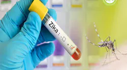 Wustl Researchers Examine Zika's Most Harmful Brain Damage With Brazilian Newborns Pic 2 19 20du 25803060023 7051707569 O Flickr Fda