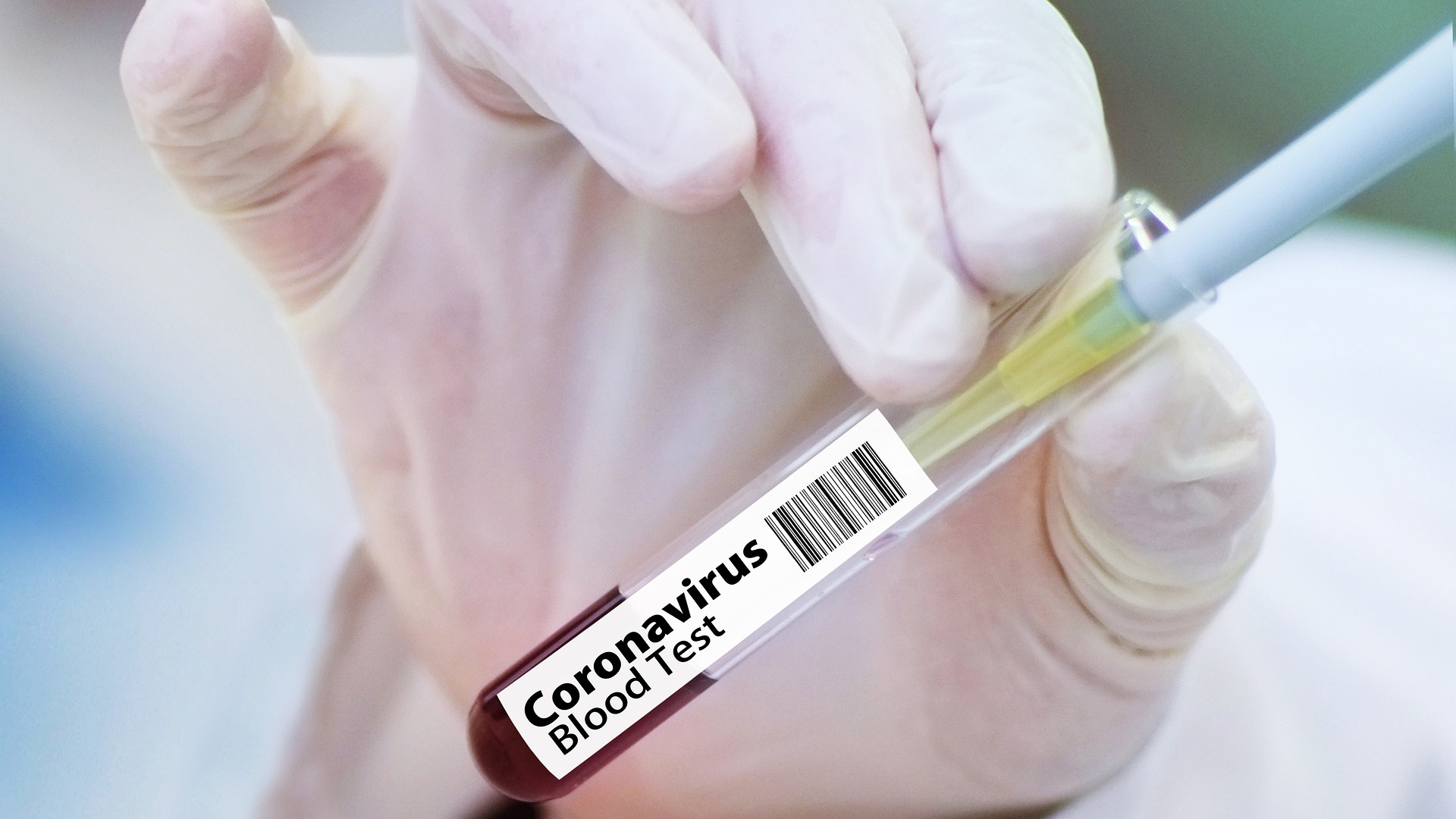 Cepheid Receives Fda Emergency Use Authorization For Rapid Sars Co V 2 Test Pic 3 23 20du Vaccine 4946480 1920 Pixabay 5e78c7fa4837c