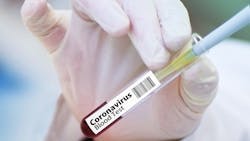 Cepheid Receives Fda Emergency Use Authorization For Rapid Sars Co V 2 Test Pic 3 23 20du Vaccine 4946480 1920 Pixabay 5e78c7fa4837c Cepheid Receives Fda Emergency Use Authorization For Rapid Sars Co V 2 Test Pic 3 23 20du Vaccine 4946480 1920 Pixabay 5e78c7fa4837c