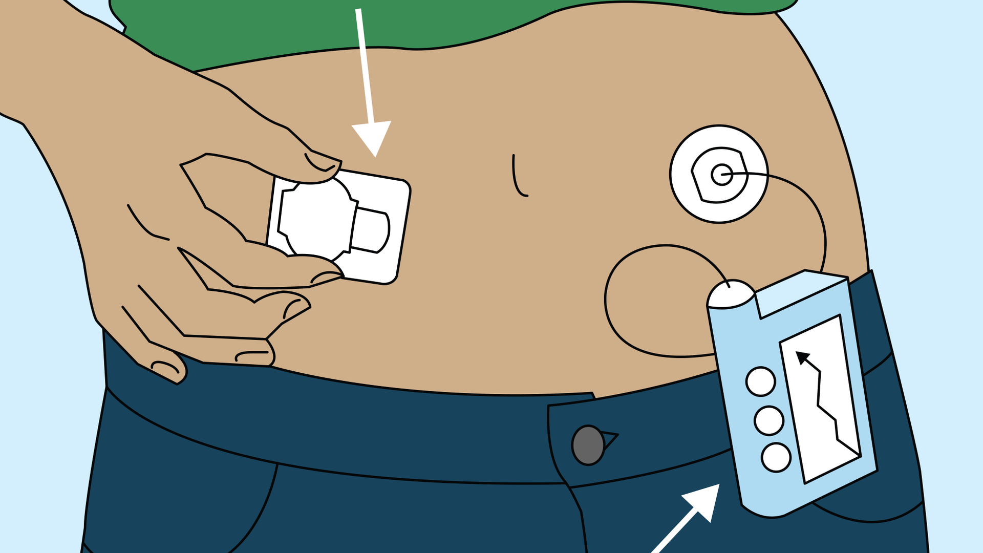 Fda Informs Patients Providers And Manufacturers About Potential Cybersecurity Vulnerabilities In Certain Medical Devices With Bluetooth Low Energy Pic 3 5 20du 15657970628 110962b09c O Fda Flickr 5e6130bc14100