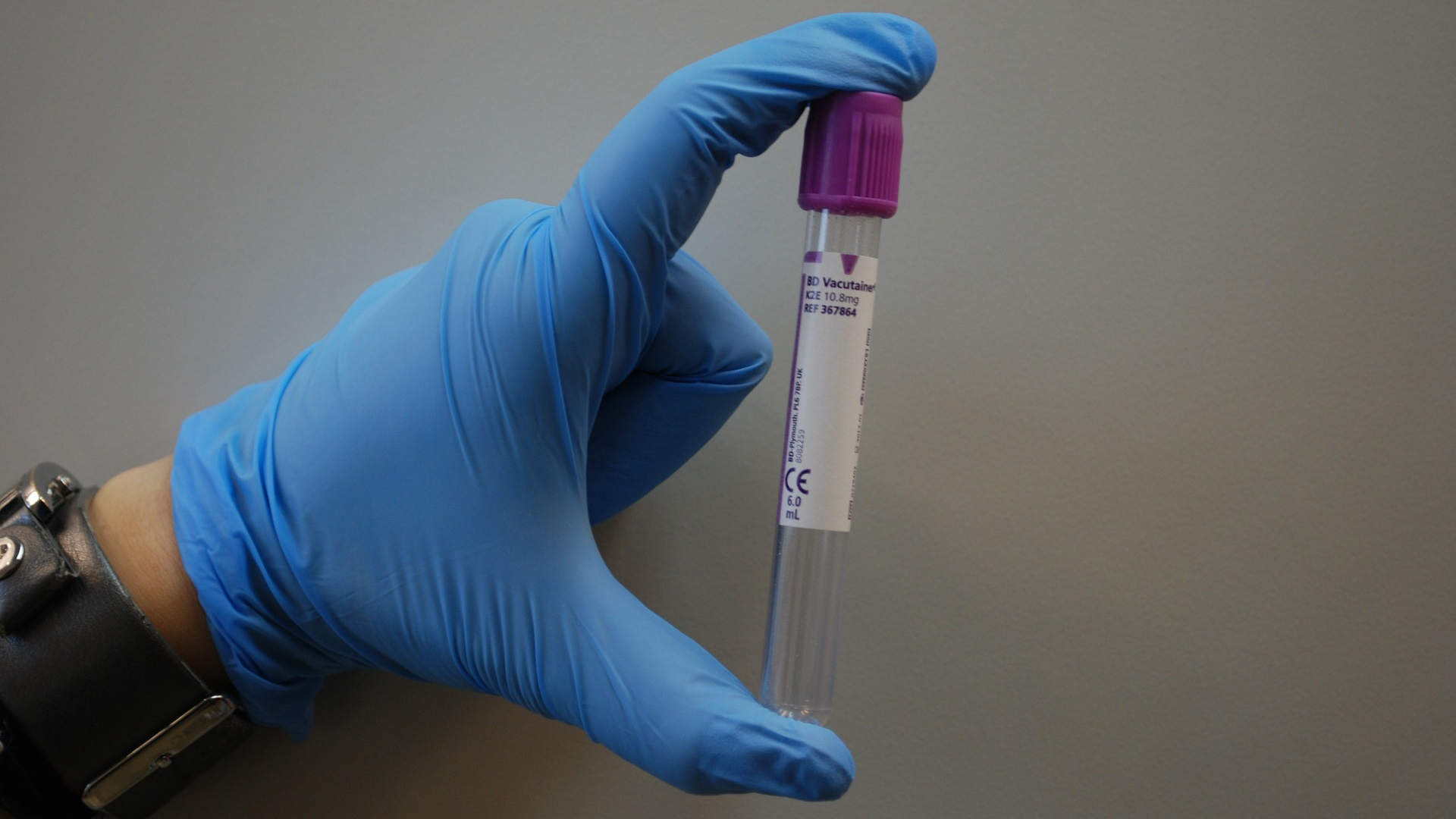 Hhs Supports Development Of First High Throughput Covid 19 Diagnostic Test Pic 3 12 20du Laboratory 313862 1920 Pixabay 5e6a4ef3dc795