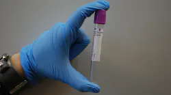 Hhs Supports Development Of First High Throughput Covid 19 Diagnostic Test Pic 3 12 20du Laboratory 313862 1920 Pixabay