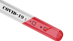 Medica Waives All Cost Sharing For Covid 19 Testing Pic 3 11 20du Covid 19 4908690 1920 1 Pixabay 5e68f42b1503a Medica Waives All Cost Sharing For Covid 19 Testing Pic 3 11 20du Covid 19 4908690 1920 1 Pixabay 5e68f42b1503a