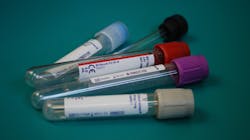 Roche Covid 19 Test Receives Fda Eua And Is Available In Select Markets Pic 3 16 20du Laboratory 313864 1920 Pixabay 5e6f8f78421e9 Roche Covid 19 Test Receives Fda Eua And Is Available In Select Markets Pic 3 16 20du Laboratory 313864 1920 Pixabay 5e6f8f78421e9